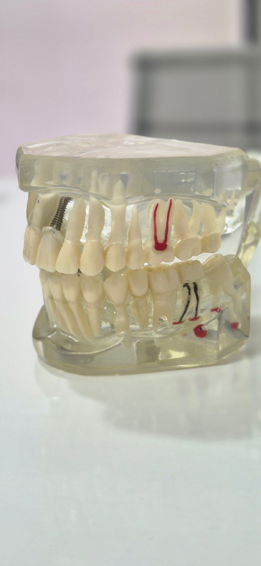 Implant and root canal demonstration model